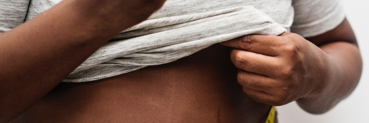 Support Group for Fatties